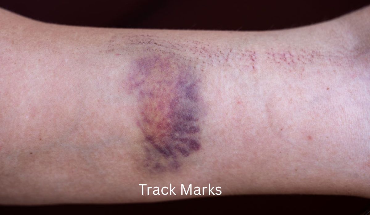Track Marks